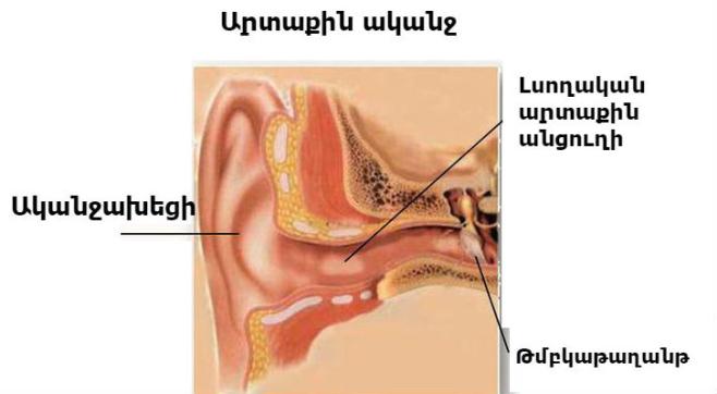 Կարծիքի ճշգրտում և ճշմարտության վերականգնում